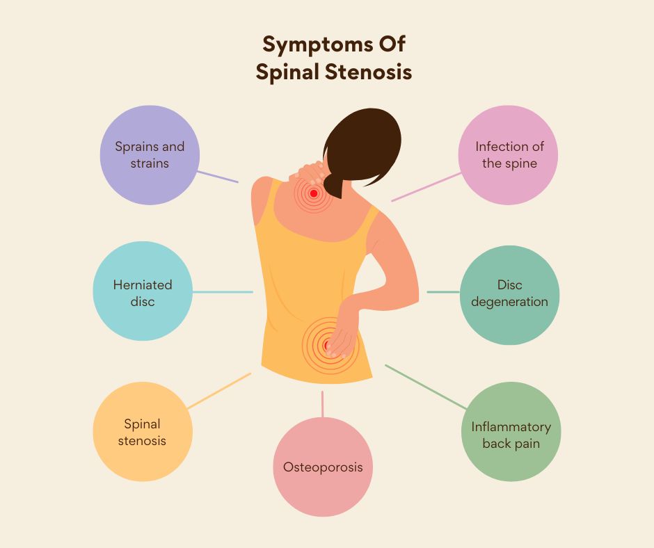 Spinal Stenosis Symptoms Spinal Stenosis Symptoms