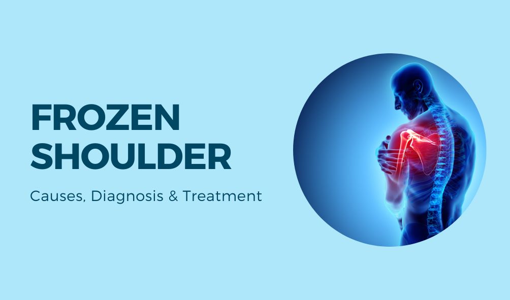 Frozen Shoulder | Causes, Diagnosis & Treatment