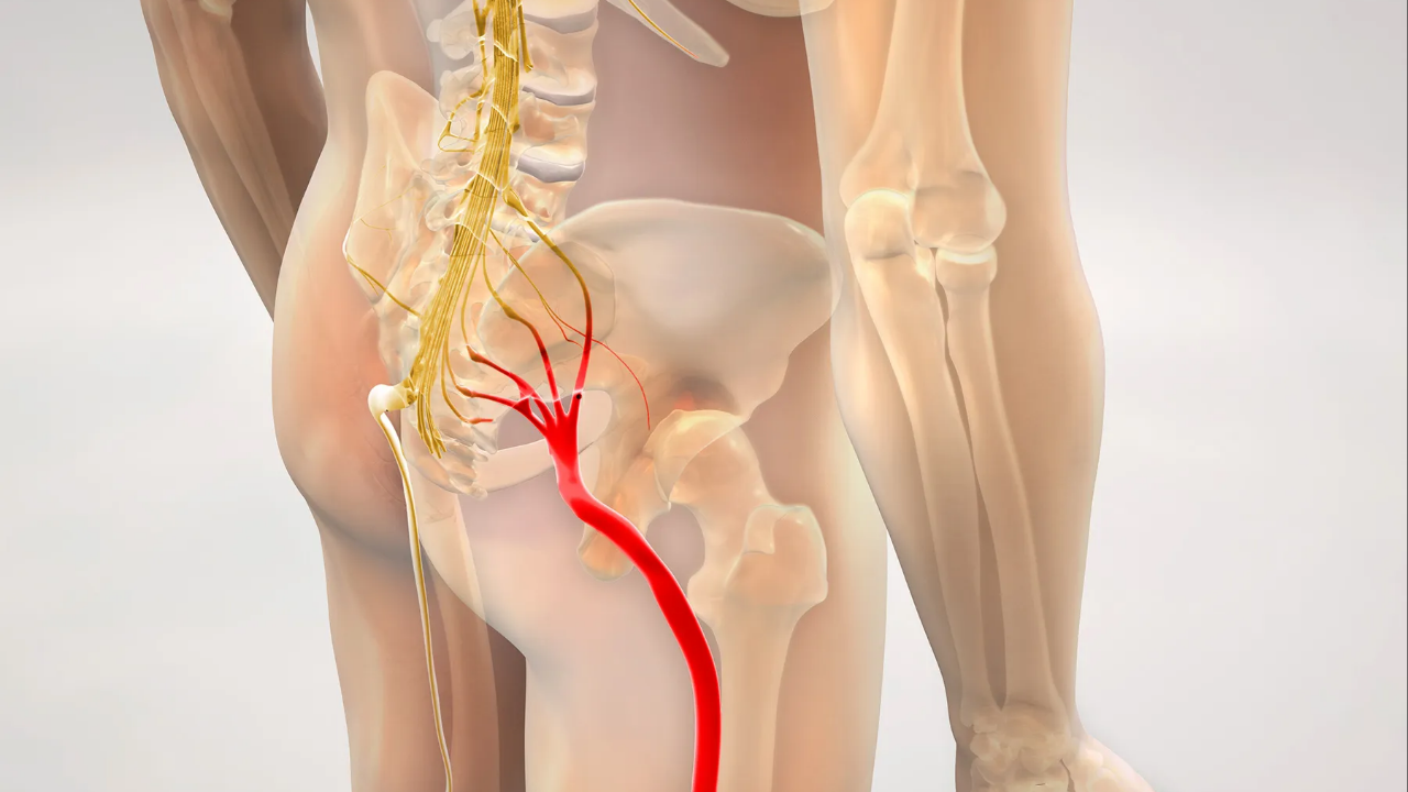 Spinal Decompression and Sciatica Relief in Islamabad: A Safe Non-Surgical Approach at Theramed Neuro Therapies DHA 2